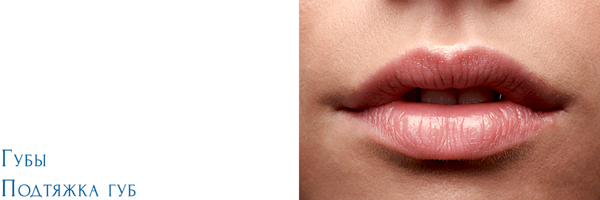 Lippen / Liplift